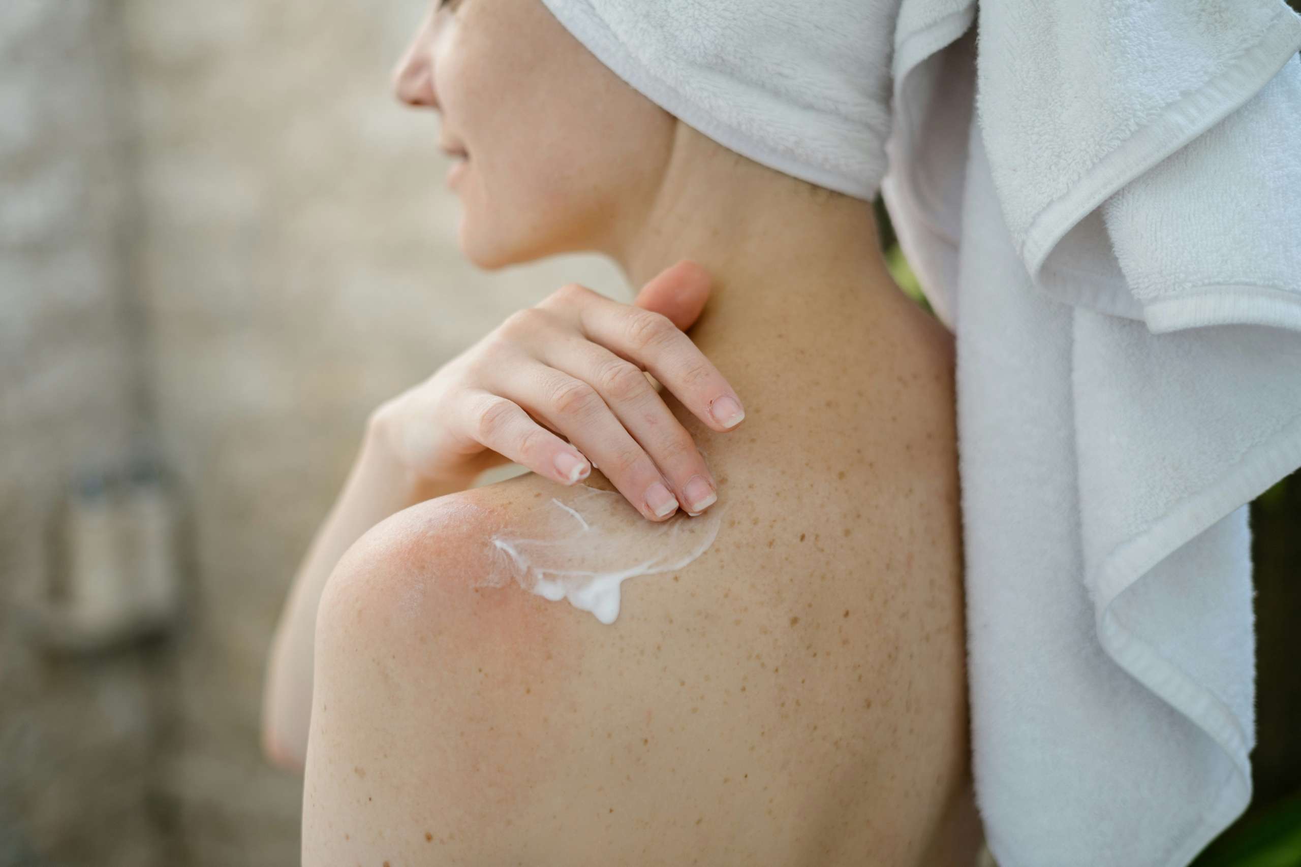 Understanding Lichen Sclerosus: Recognizing and Treating a Common Gynecologic Condition