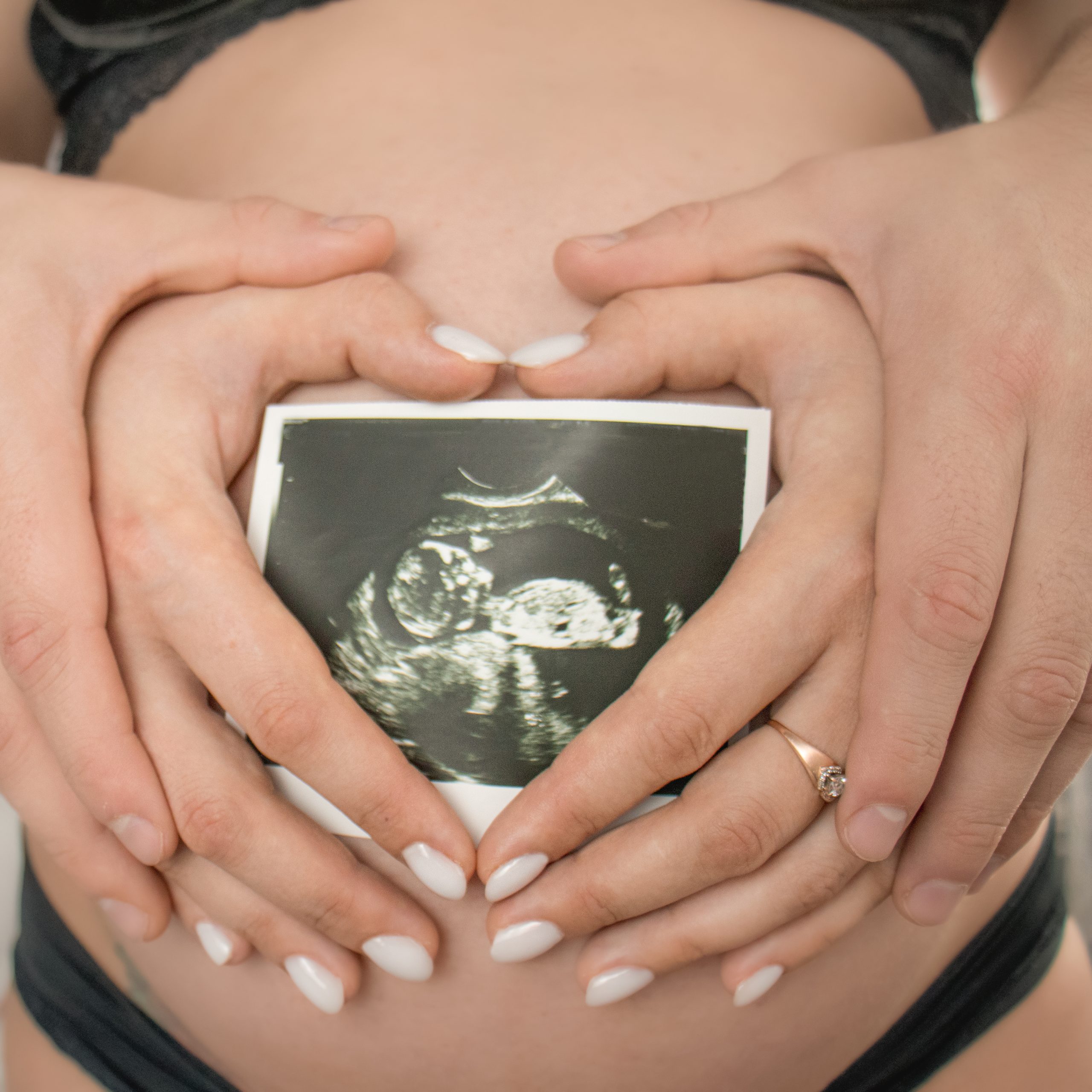 Close up cropped photo of a couple's hands holding an ultrasound photo on her pregnant tummy. 