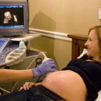 4D Ultrasound - MacArthur Medical Center